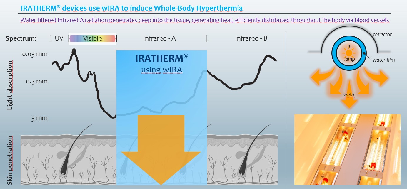 IRATHERM®1000: O Sistema de hipertermia de Cuerpo Entero (WBH) Certificado com Radiação Pure wIRA® – Potência e Valor Clínico Incomparáveis